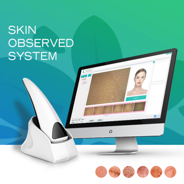 2022 New Model Portable Skin Analyzer